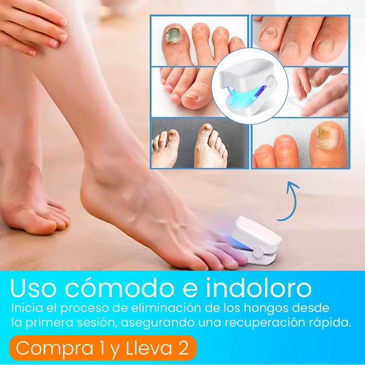 CuraLáser: Elimina los Hongos en Solo 6 Ciclos - Compra 1 y Lleva 2